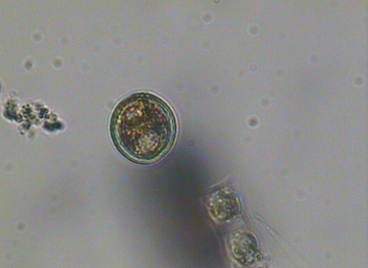 Dictyocha speculum